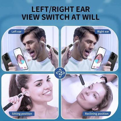 Smart Visual Earwax Removal Tool | أداة إزالة شمع الأذن الذكية